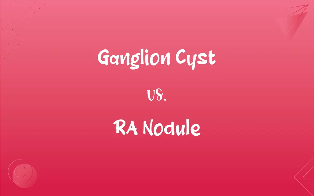 Ganglion Cyst Vs RA Nodule What s The Difference 